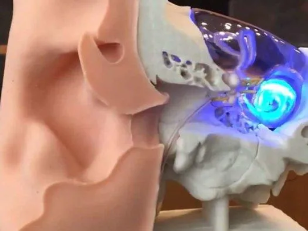 как светодиоды лечат слух, как LED используют в медицине, современные исследования лед